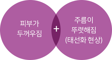 피부가 두꺼워잠+주름이 뚜렷해짐